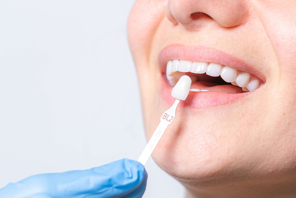 tooth whitening